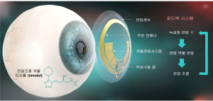 POSTECH 신소재공학과 연구팀, 녹내장 안압 진단 및 치료 스마트 콘택트렌즈 기술 개발
