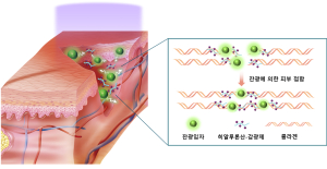 이제 상처엔 연고 대신 '빛'으로 치료한다