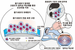 POSTECH · 동국대병원 · 네이처글루텍 공동연구팀, 관절염 치료 가능성 높인다